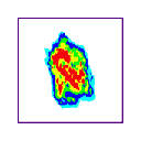 Skin Cancer Image Search